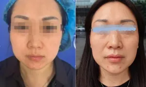 Người vợ giấu chồng vay tiền đi làm đẹp